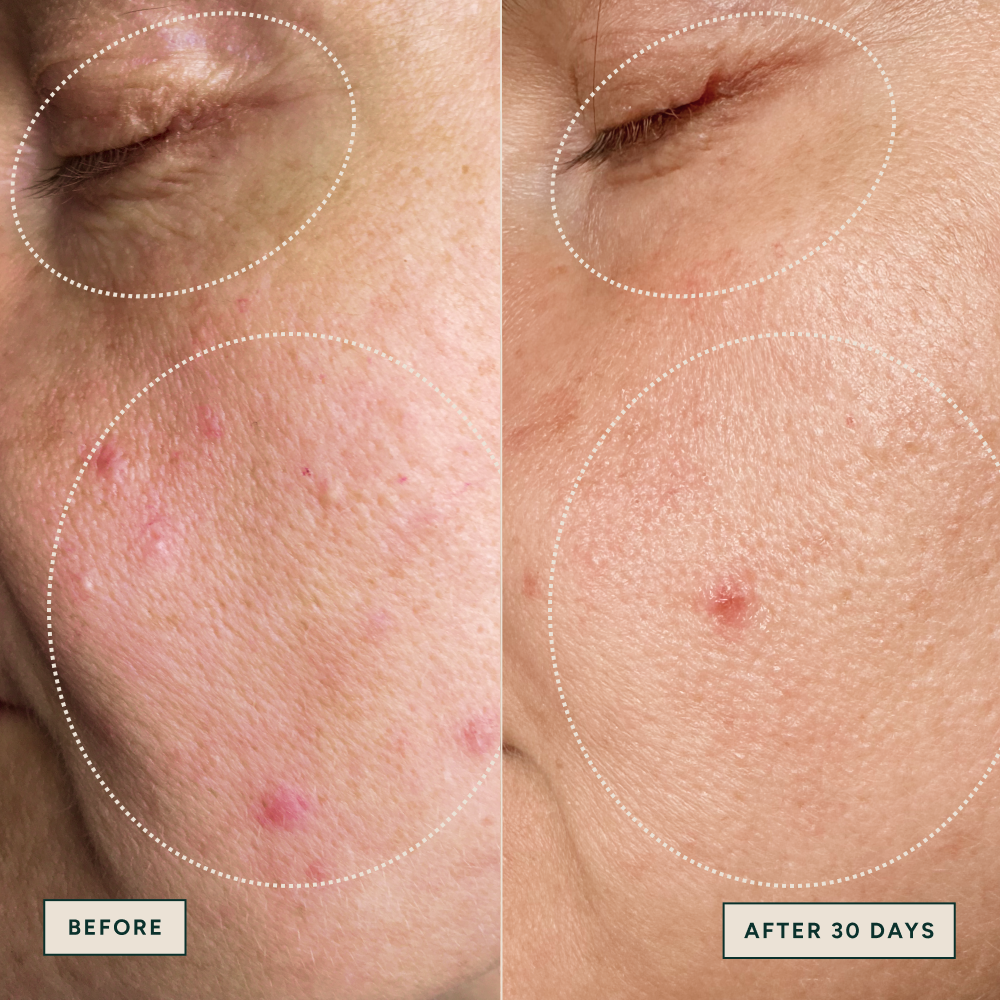 Azelaic Dark Spot Serum 30ml