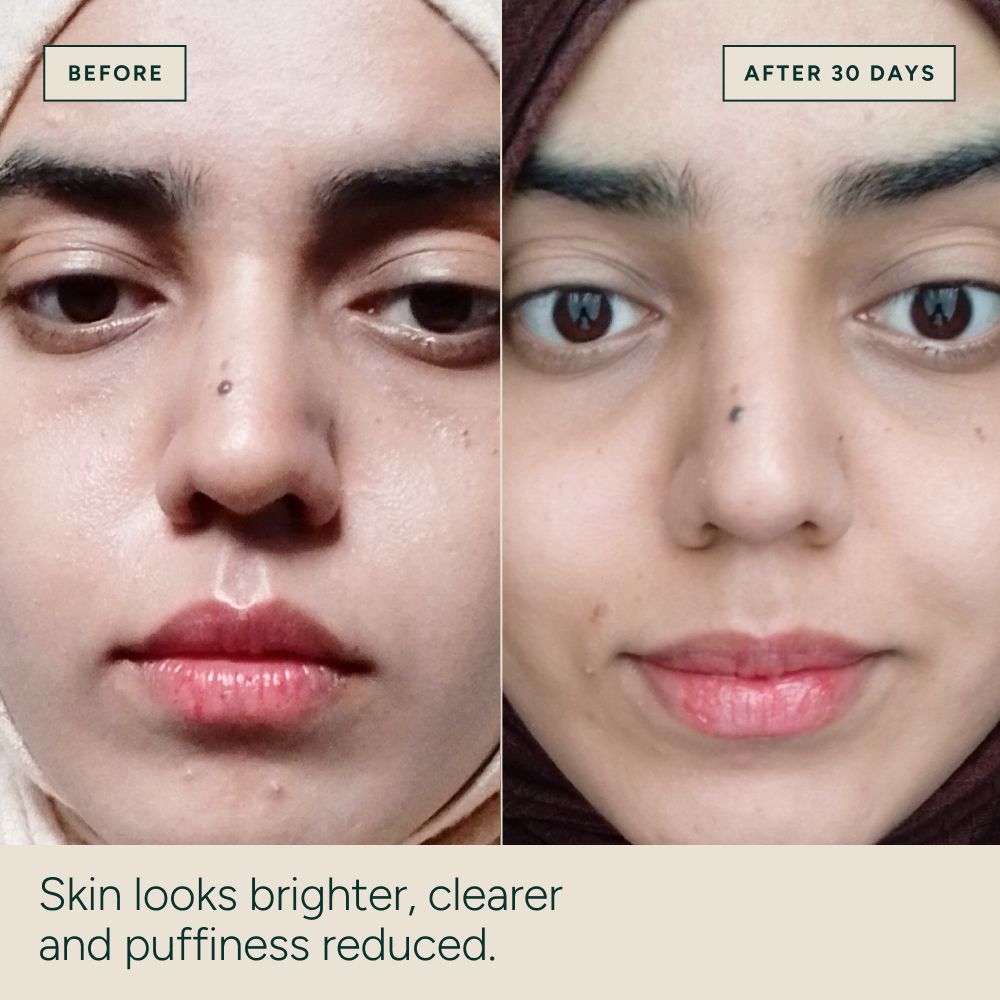 Vitamin C Repair Serum 30ml