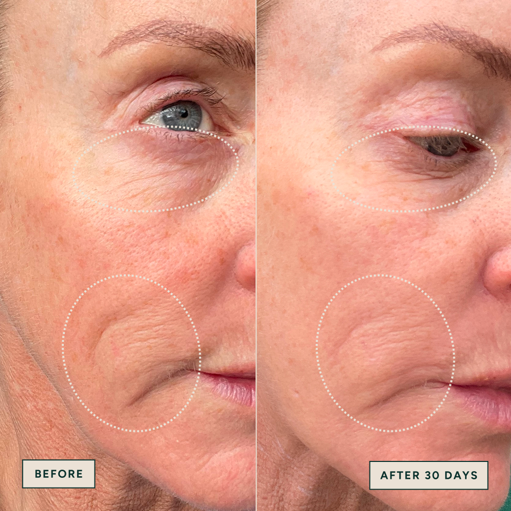 Azelaic Dark Spot Serum 30ml