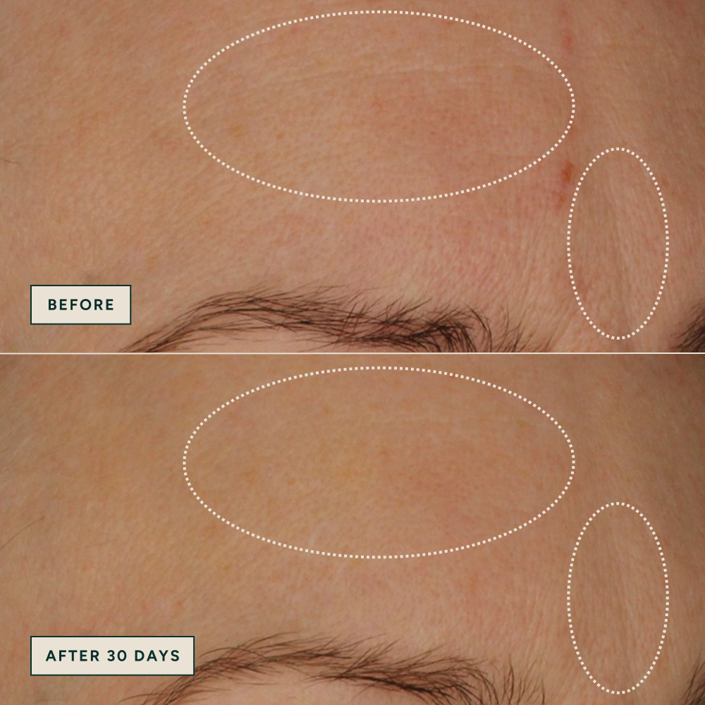 Azelaic Dark Spot Serum 30ml