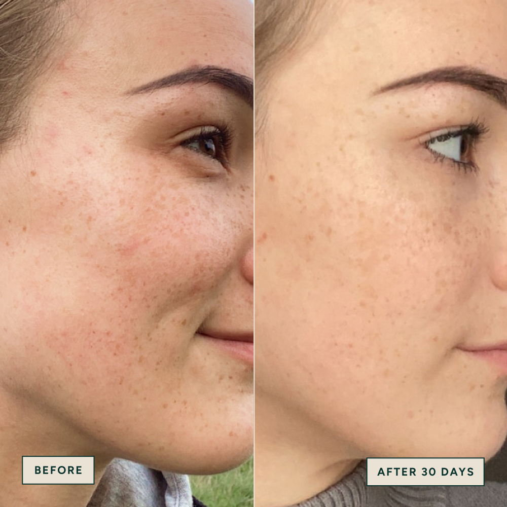 Niacinamide Complexion Booster 30ml