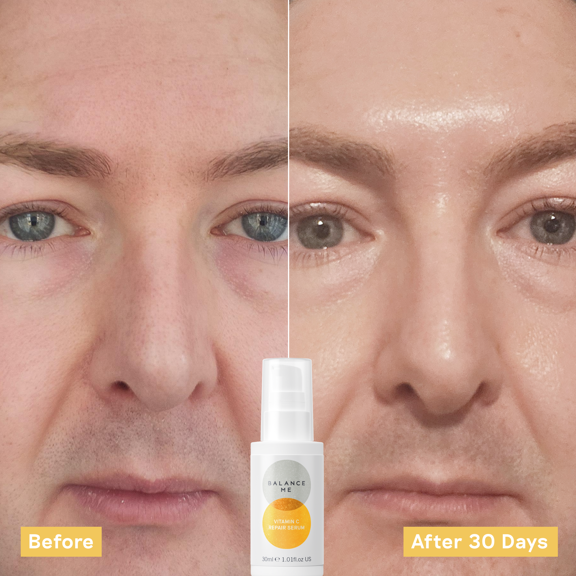 Vitamin C Repair Serum Duo 30ml x 2